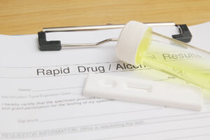 a clipboard with alcohol etg testing paperwork attached